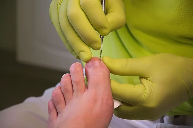 Manos con guantes realizando el cuidado de una uña del pie